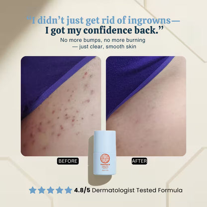 High Roller Ingrown Tonic